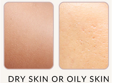 dry skin or oil skin.jpg